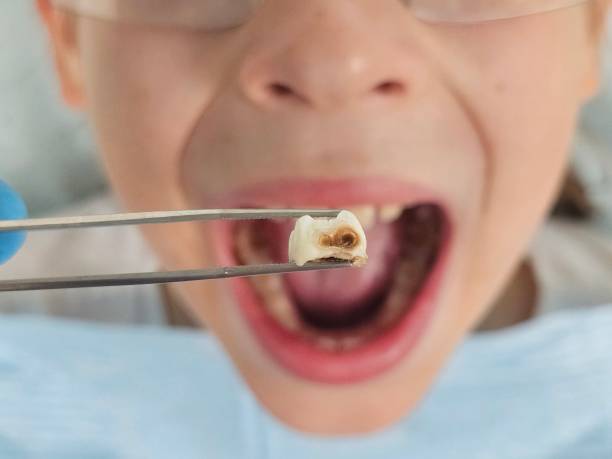 Best Tooth Pain Emergency Relief  in San Francisco, CA